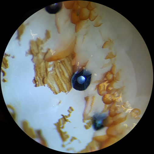 Sea scallop’s eyes under microscope